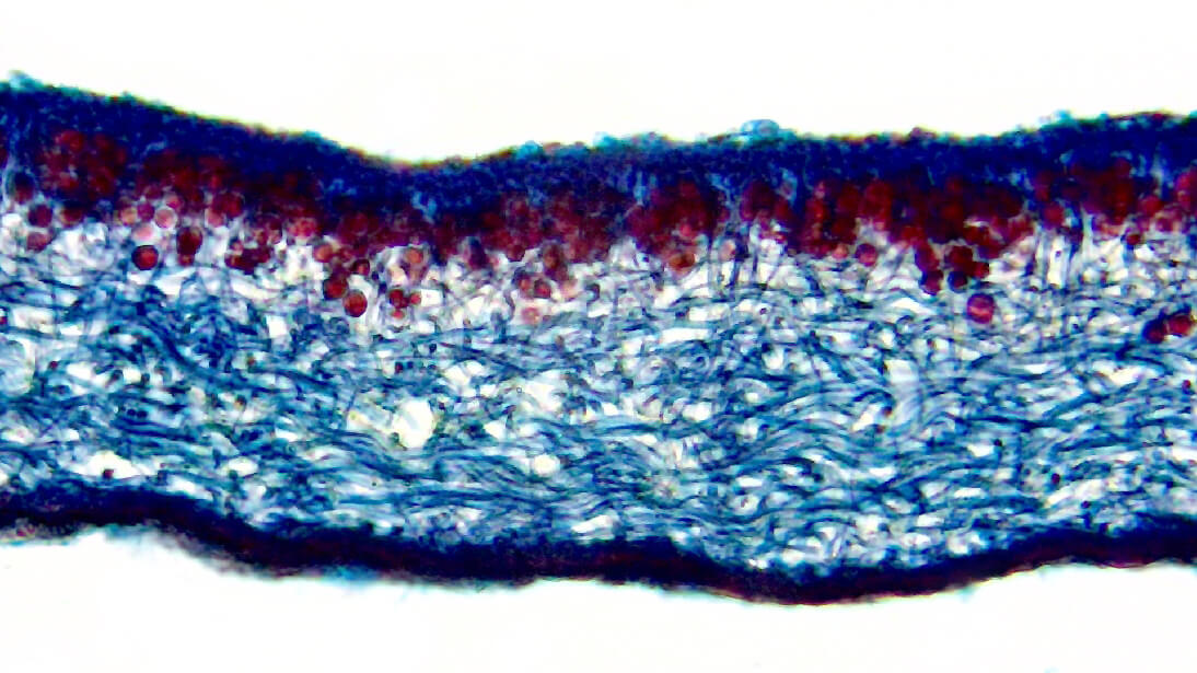 Срез лишайника. Камера Микромед Эврика 1.3 MP-AC, ахромат 40х/0.65, оптический адаптер 0.5х.